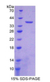 LDHB / Lactate Dehydrogenase B Protein - Recombinant Lactate Dehydrogenase B By SDS-PAGE