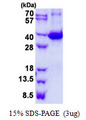 LGALS9 / Galectin 9 Protein