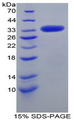 LRP1 / CD91 Protein - Recombinant Low Density Lipoprotein Receptor Related Protein 1 By SDS-PAGE