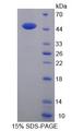 LSR / LISCH7 Protein - Recombinant  Lipolysis Stimulated Lipoprotein Receptor By SDS-PAGE