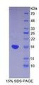 LY96 / MD2 / MD-2 Protein - Recombinant Lymphocyte Antigen 96 By SDS-PAGE