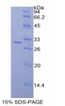 MAdCAM-1 Protein - Recombinant Mucosal Addressin Cell Adhesion Molecule 1 By SDS-PAGE