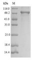 MASP2 / MASP-2 Protein - (Tris-Glycine gel) Discontinuous SDS-PAGE (reduced) with 5% enrichment gel and 15% separation gel.