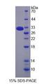 MBL2 / Mannose Binding Protein Protein - Recombinant  Mannose Binding Lectin By SDS-PAGE