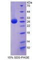 MBP / Myelin Basic Protein Protein - Recombinant Myelin Basic Protein By SDS-PAGE