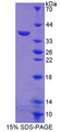 Metallothionein 1 Protein - Recombinant  Metallothionein 1 By SDS-PAGE
