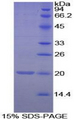 MGP / Matrix Gla-Protein Protein - Recombinant Matrix Gla Protein By SDS-PAGE
