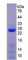 MMP1 Protein - Recombinant Matrix Metalloproteinase 1 (MMP1) by SDS-PAGE
