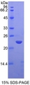 MMP13 Protein - Recombinant Matrix Metalloproteinase 13 By SDS-PAGE