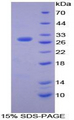 MMP15 Protein - Recombinant Matrix Metalloproteinase 15 By SDS-PAGE