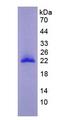 MMP9 / Gelatinase B Protein - Eukaryotic Matrix Metalloproteinase 9 (MMP9) by SDS-PAGE