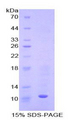 MT3 / Metallothionein 3 Protein - Recombinant Metallothionein 3 By SDS-PAGE