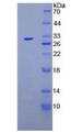 MUC16 / CA125 Protein - Recombinant Carbohydrate Antigen 125 By SDS-PAGE