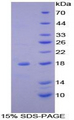NDUFAB1 / ACP Protein - Recombinant Acyl Carrier Protein, Mitochondrial By SDS-PAGE