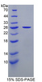 NME5 Protein - Recombinant  Non Metastatic Cells 5, Protein NM23A Expressed In By SDS-PAGE