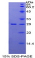 ORM2 / Orosomucoid 2 Protein - Recombinant Orosomucoid 2 By SDS-PAGE