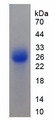 P450SCC / CYP11A1 Protein - Recombinant Cytochrome P450 11A1 By SDS-PAGE