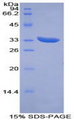 PINK1 Protein - Recombinant PTEN Induced Putative Kinase 1 By SDS-PAGE