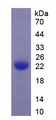 PLAT / TPA Protein - Recombinant Plasminogen Activator, Tissue By SDS-PAGE