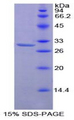 PRKCZ / PKC-Zeta Protein - Recombinant Protein Kinase C Zeta By SDS-PAGE