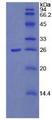 PTX3 / Pentraxin 3 Protein - Recombinant Pentraxin 3, Long By SDS-PAGE