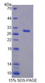RNF112 / ZNF179 Protein - Recombinant Brain Finger Protein By SDS-PAGE