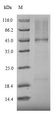 RORC / ROR Gamma Protein - (Tris-Glycine gel) Discontinuous SDS-PAGE (reduced) with 5% enrichment gel and 15% separation gel.