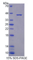 S100A10 Protein - Recombinant S100 Calcium Binding Protein A10 By SDS-PAGE