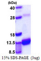 S100A4 / FSP1 Protein