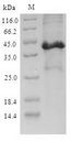 SCGB3A2 Protein - (Tris-Glycine gel) Discontinuous SDS-PAGE (reduced) with 5% enrichment gel and 15% separation gel.