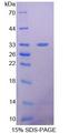 SDHA Protein - Recombinant  Succinate Dehydrogenase Complex Subunit A By SDS-PAGE