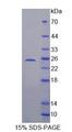SDHB Protein - Recombinant  Succinate Dehydrogenase Complex Subunit B By SDS-PAGE