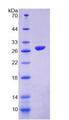 SIRPB1 / CD172b Protein - Recombinant Signal Regulatory Protein Beta 1 By SDS-PAGE