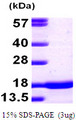 SNCA / Alpha-Synuclein Protein