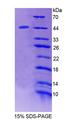 STAM2 Protein - Recombinant  Signal Transducing Adaptor Molecule 2 By SDS-PAGE