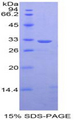 STAT1 Protein - Recombinant  Signal Transducer And Activator Of Transcription 1 By SDS-PAGE