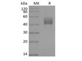 TGFBR1 / ALK5 Protein - Recombinant Mouse ALK-5/TGFBR1 (C-Fc)