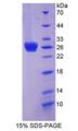 THSD7A Protein - Recombinant Thrombospondin Type I Domain Containing Protein 7A By SDS-PAGE