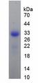 TNFRSF11A / RANK Protein - Recombinant Receptor Activator Of Nuclear Factor Kappa B By SDS-PAGE