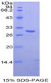 TXK / RLK Protein - Recombinant TXK Tyrosine Kinase By SDS-PAGE
