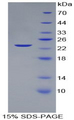 VEGF 145 Protein - Recombinant Vascular Endothelial Growth Factor 145 By SDS-PAGE