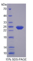 XCR1 Protein - Recombinant Chemokine C-Motif Receptor 1 By SDS-PAGE