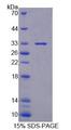 XYLT1 / XylT-I Protein - Recombinant Xylosyltransferase I (XYLT1) by SDS-PAGE