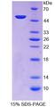 ZRP-1 / TRIP6 Protein - Recombinant  Thyroid Hormone Receptor Interactor 6 By SDS-PAGE