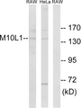 MOV10L1 Antibody - Western blot analysis of lysates from HeLa and RAW264.7 cells, using MOV10L1 Antibody. The lane on the right is blocked with the synthesized peptide.