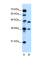MPG Antibody - MPG antibody ARP44694_P050-NP_001015052-MPG(N-methylpurine-DNA glycosylase) Antibody Western blot of Jurkat lysate.  This image was taken for the unconjugated form of this product. Other forms have not been tested.