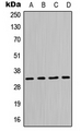 MPG Antibody - Western blot analysis of MPG expression in Jurkat (A); HeLa (B); Raw264.7 (C); PC12 (D) whole cell lysates.
