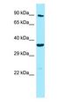 MPP4 / Discs Large Homolog 6 Antibody - MPP4 / Discs Large Homolog 6 antibody Western Blot of Jurkat.  This image was taken for the unconjugated form of this product. Other forms have not been tested.