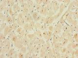 MPPED1 Antibody - Immunohistochemistry of paraffin-embedded human heart tissue using antibody at dilution of 1:100.