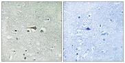 MPS1 / TTK Antibody - Peptide - + Immunohistochemistry analysis of paraffin-embedded human brain tissue using TTK (Ab-676) antibody.